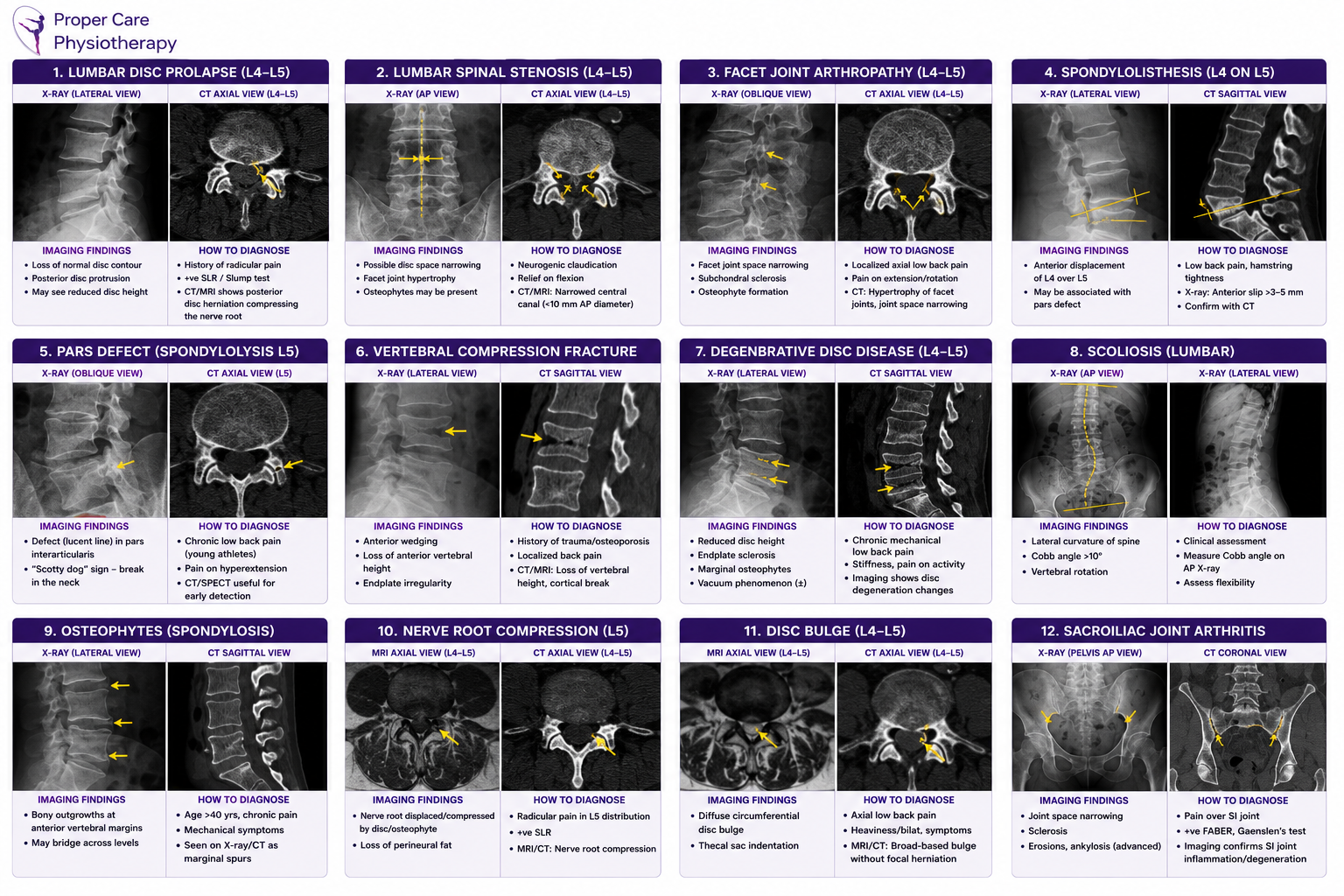 xray ct spine findings